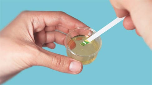 Dica de uso para fitas teste ph urina